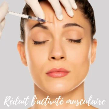 Botox et les injections de Dysport améliorent les rides du visage en paralysant temporairement les muscles du visage.